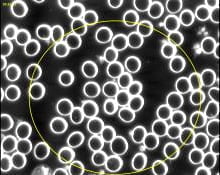 An image of the blood cells after using Blushield
