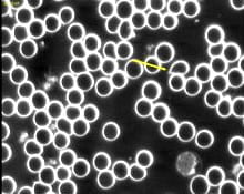 An image of the blood cells after using Blushield