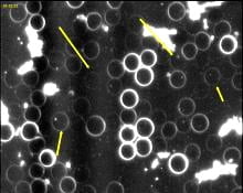 An image of the blood cells before using Blushield