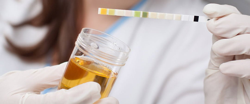 A photo of a scientist testing urine with a stick